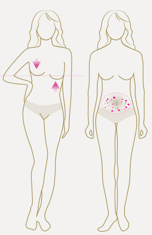 LIPOELASTIC post-surgery compression garments are
designed for postoperative treatment